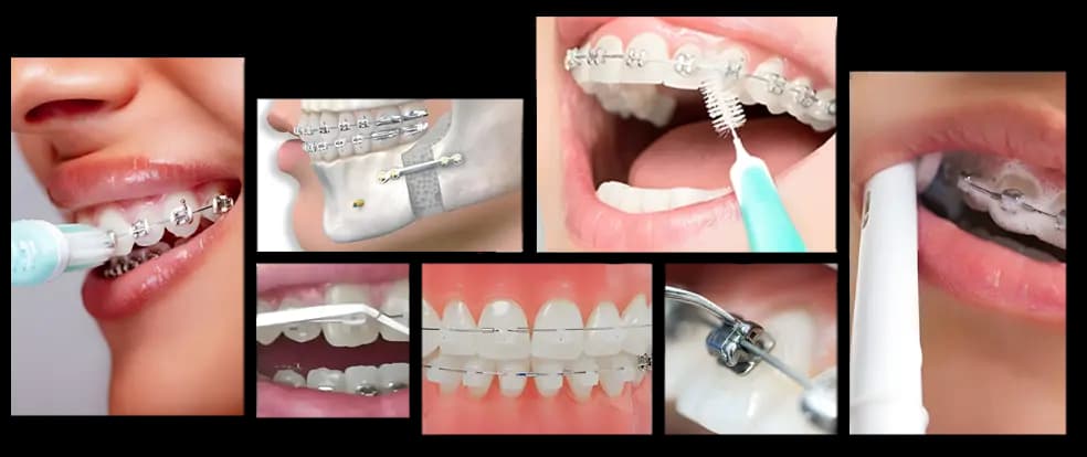 گالری تصاویر درمان دکتر ایل ناز احرامی